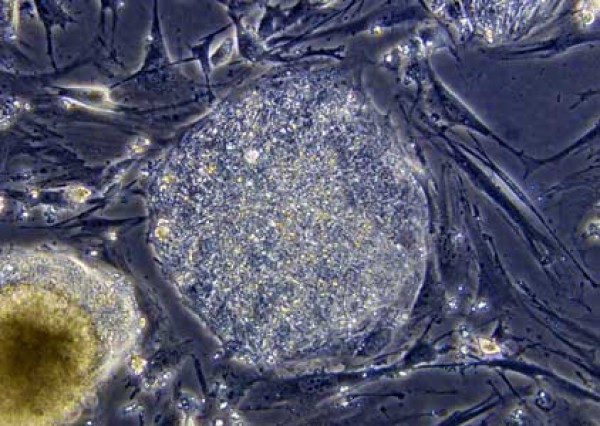 stem cell; courtesy of Amy Shah http://www.amyshah.com/